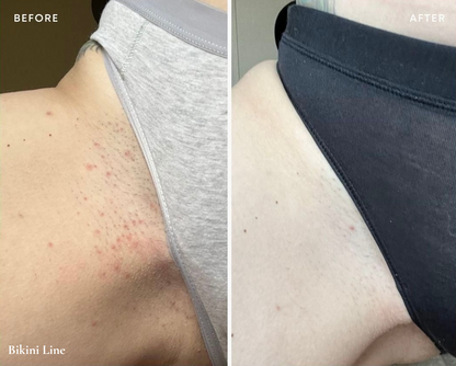 Glazed Donut Shave Bundle